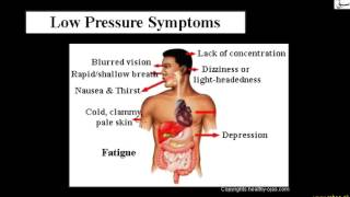 Hypotension