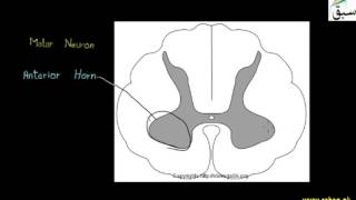 Poliomyelitis