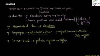 Sciatica