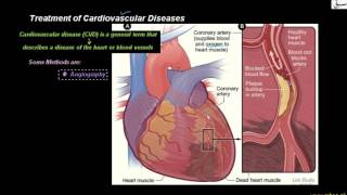 Treatment of Cardiovascular Diseases