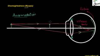 Shortsightedness
