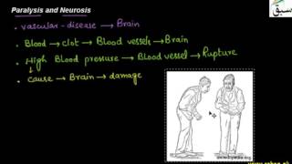 Paralysis, Neurosis