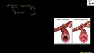Pneumonia, Asthma