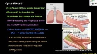 Cystic Fibrosis
