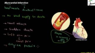 Atherosclerosis and Arteriosclerosis