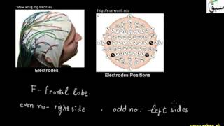 Electroencephalography(EEG)