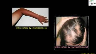 Biological effects of radiation