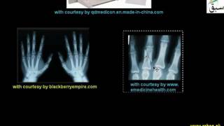 Uses of X-Ray