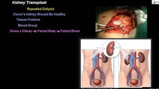 Kidney Transplant
