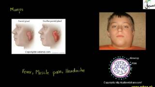 Small Pox, Mumps, Influenza