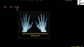 Radiation exposure