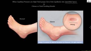 Capillaries