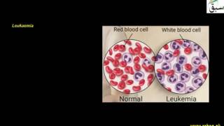 Cancer Types