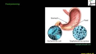 Dyspepsia, Food Poisoning