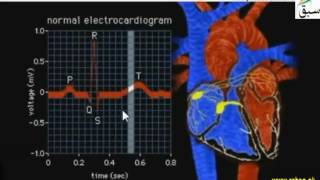 Electrocardiography(ECG)