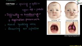Genetic Causes