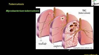 Bacterial Diseases in Man