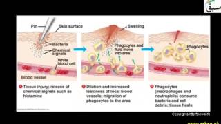 Inflammatory Response as one of the non specific Defenses