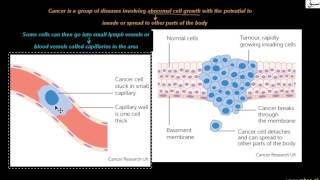 Lymphatic System & Cancer