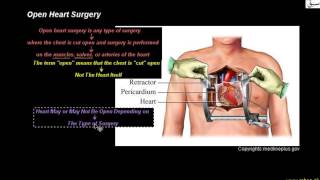 Open Heart Surgery