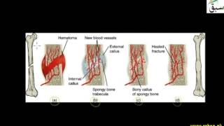 Repair of Broken Bones